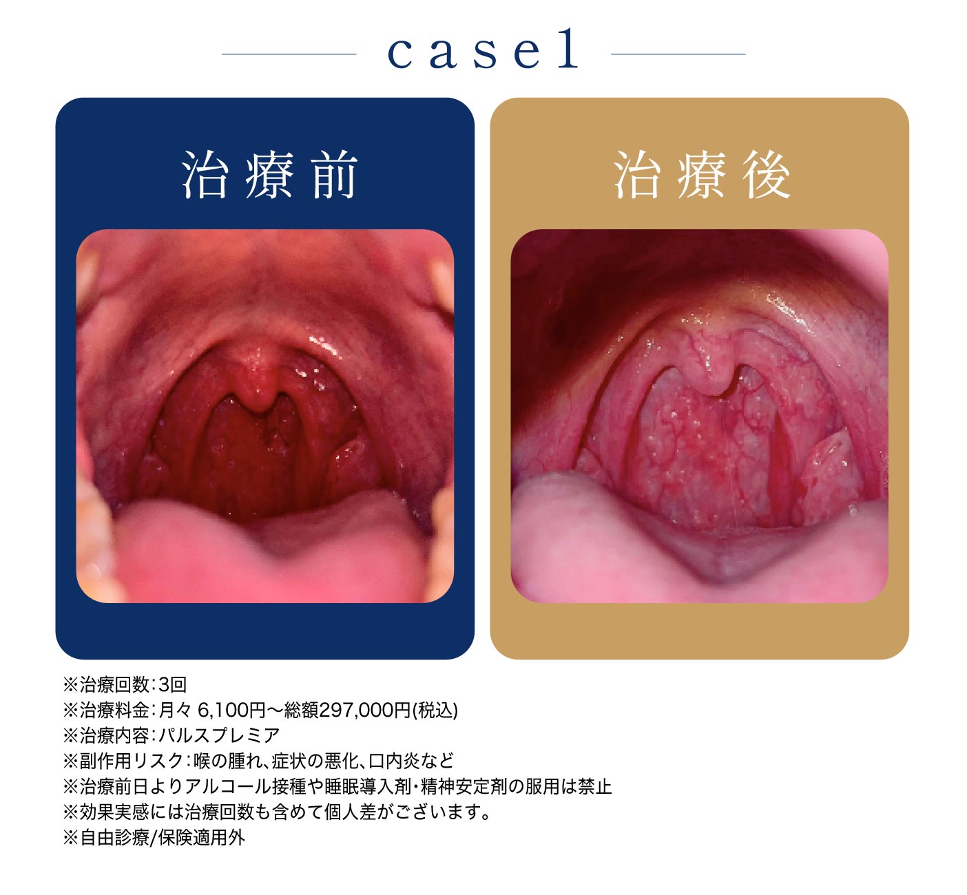 治療前・治療後
