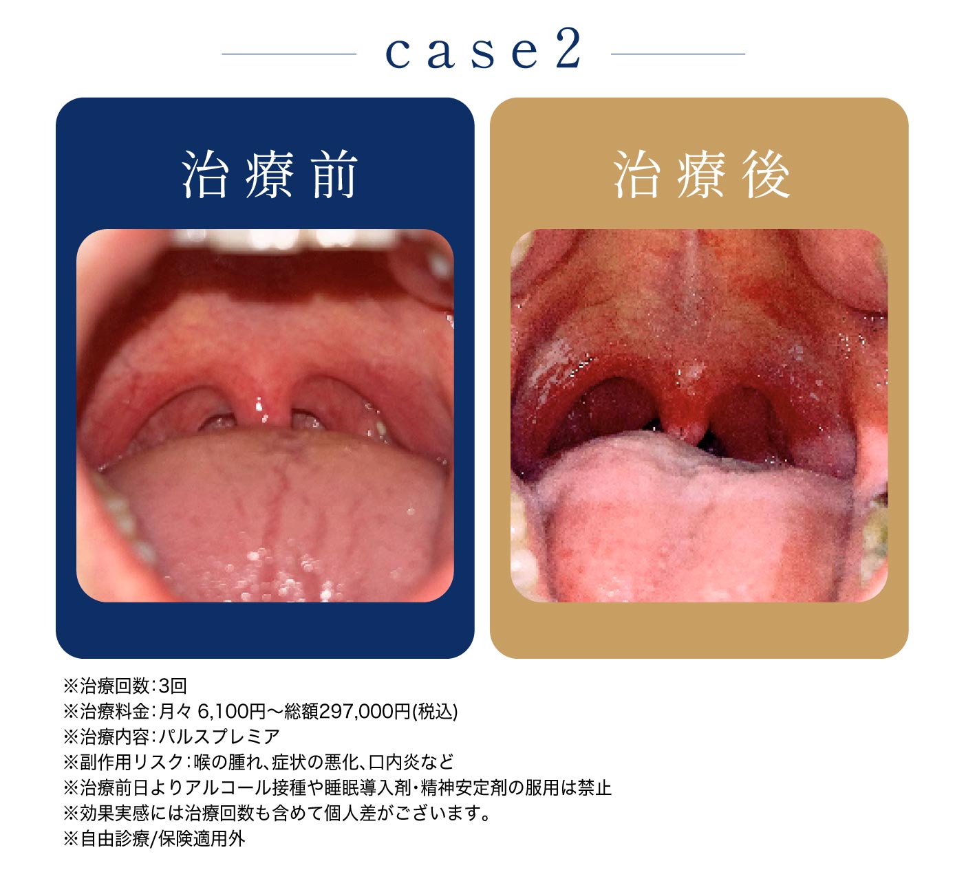 治療前・治療後